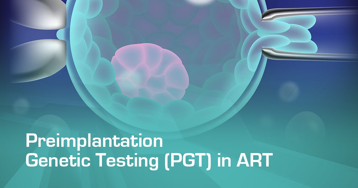 Preimplantation Genetic Testing (PGT) in ART